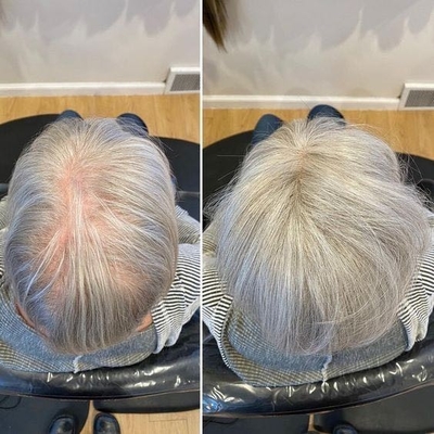 Different color gray hair toppers for customize China factory directly supplier wholesale ptice