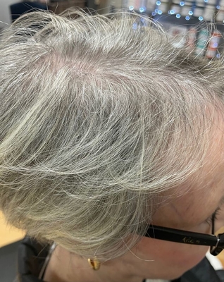 3x5 mono topper with gray color for old lady 100% human hair women topper for thin hair